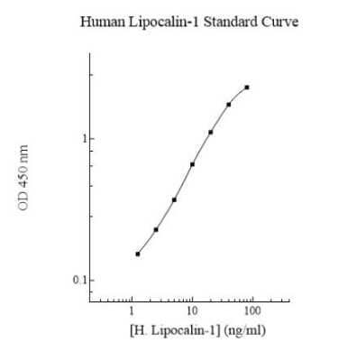 ELISA: Human Lipocalin-1 ELISA Kit (Colorimetric) [NBP3-18729]