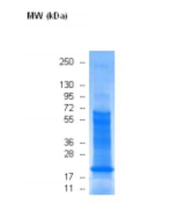 Western Blot: Human Lymph Node Whole Tissue Lysate (Adult Whole Normal) [NB820-59242]