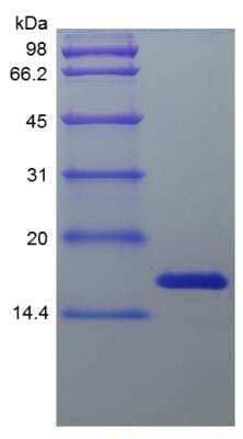 SDS-PAGE: Recombinant Human Midkine Protein [NBP2-34997]