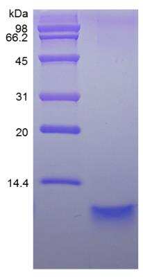 SDS-PAGE: Recombinant Human NRG1 beta2 Protein [NBP2-35099]