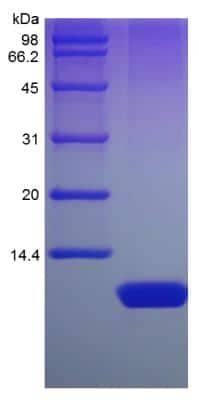 SDS-PAGE: Recombinant Human Nesfatin-1/Nucleobindin-2 Protein [NBP2-35072]