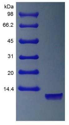 SDS-PAGE: Recombinant Human Neuregulin-1 alpha/NRG1 alpha Protein [NBP2-35093]