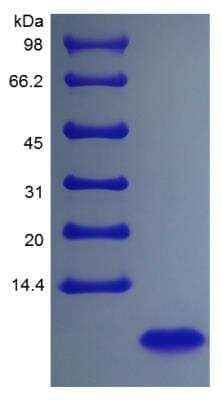 SDS-PAGE: Recombinant Human Neuregulin-1 beta 1/NRG1 beta 1 Protein [NBP2-35097]