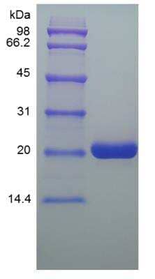 SDS-PAGE: Recombinant Human Oncostatin M/OSM Protein [NBP2-35115]