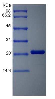 SDS-PAGE: Recombinant Human Oncostatin M/OSM Protein [NBP2-35113]