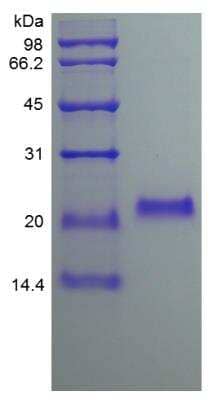 SDS-PAGE: Recombinant Human Osteoprotegerin/TNFRSF11B Protein [NBP2-35108]