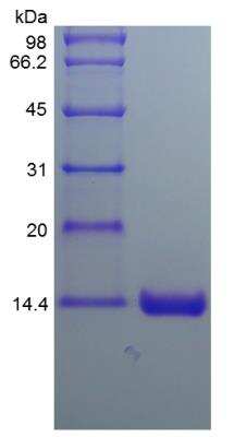 SDS-PAGE: Recombinant Human Otoraplin/OTOR Protein [NBP2-35197]