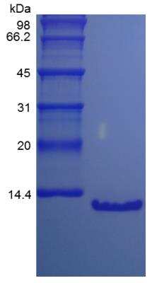 SDS-PAGE: Recombinant Human PTH 15N Stable Isotope Protein [NBP2-35217]