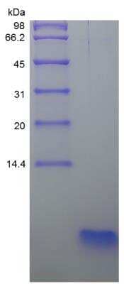 SDS-PAGE: Recombinant Human PTH Protein [NBP2-35215]