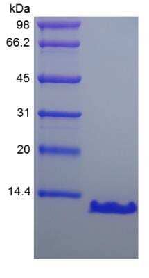 SDS-PAGE: Recombinant Human PTH Protein [NBP2-35216]