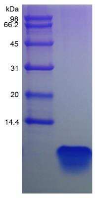 SDS-PAGE: Recombinant Human PTH Protein [NBP2-35212]