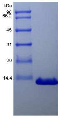 SDS-PAGE: Recombinant Human PTHLH/PTHrP Protein [NBP2-35224]