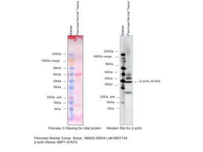 Western Blot: Human Pancreas Whole Tissue Lysate (Adult Whole Normal) [NB820-59244]