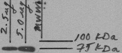 Western Blot: Human Placenta Whole Tissue Lysate (Adult Whole Normal) [NB820-59248]