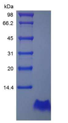 SDS-PAGE: Recombinant Human Proinsulin C-Peptide Analogue Protein [NBP2-35211]