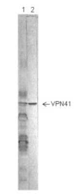 Western Blot: Human Respiratory Syncytial Virus Nucleoprotein VPN41 Antibody (4-18)BSA Free [NBP2-50535]