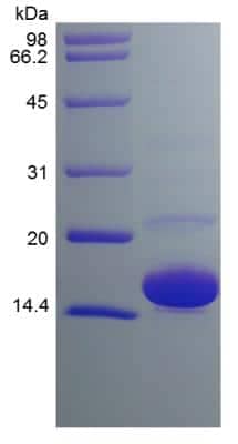 SDS-PAGE: Recombinant Human SOD1/Cu-Zn SOD Protein [NBP2-34940]