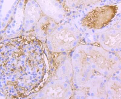 Immunohistochemistry-Paraffin: Human Serum Albumin Antibody (JF32-10) [NBP2-66894]