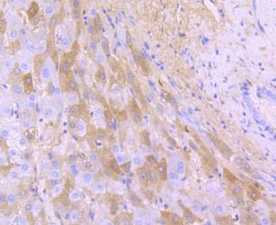 Immunohistochemistry-Paraffin: Human Serum Albumin Antibody (JF32-10) [NBP2-66894]