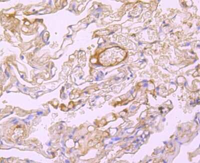 Immunohistochemistry-Paraffin: Human Serum Albumin Antibody (JF32-10) [NBP2-66894]