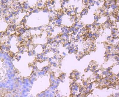 Immunohistochemistry-Paraffin: Human Serum Albumin Antibody (JF32-10) [NBP2-66894]