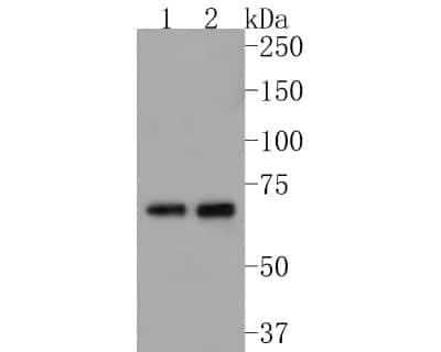 Western Blot: Human Serum Albumin Antibody (JF32-10) [NBP2-66894]