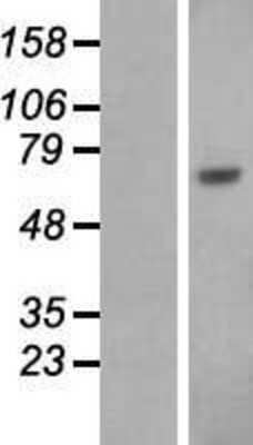 Western Blot: Human Serum Albumin Overexpression Lysate [NBL1-07449]