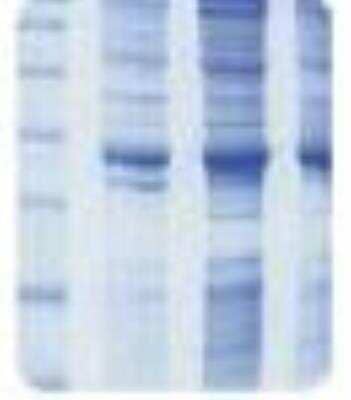 SDS-PAGE: Human Skin Whole Tissue Lysate (Adult Whole Normal) [NB820-59254]