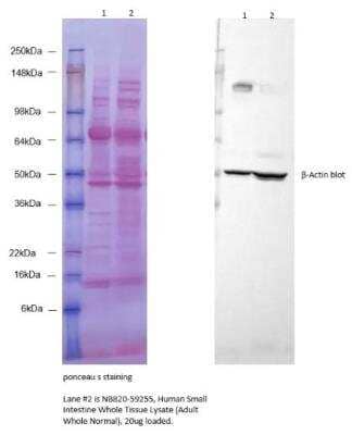 Western Blot: Human Small Intestine Whole Tissue Lysate (Adult Whole Normal) [NB820-59255]