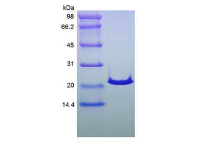 SDS-PAGE: Recombinant Human Sonic Hedgehog/Shh Protein [NBP2-35265]