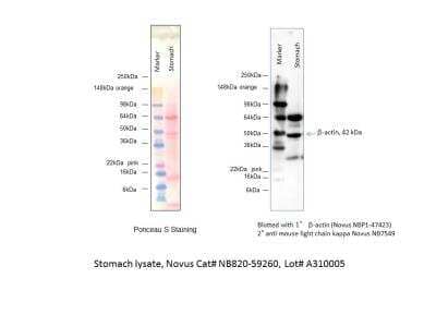 Western Blot: Human Stomach Whole Tissue Lysate (Adult Whole Normal) [NB820-59260]