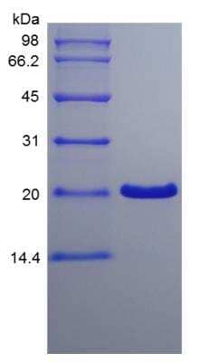 SDS-PAGE: Recombinant Human TFF1/pS2 Protein [NBP2-35042]