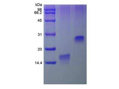 SDS-PAGE: Recombinant Human TFF3 Protein [NBP2-35060]