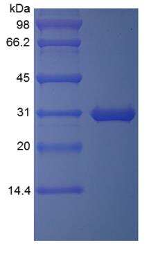 SDS-PAGE: Recombinant Human TIGAR/C12orf5 TAT Protein [NBP2-35063]