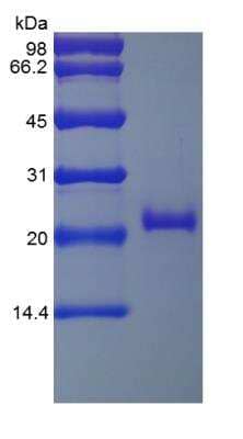 SDS-PAGE: Recombinant Human TNF RII/TNFRSF1B Protein [NBP2-35275]