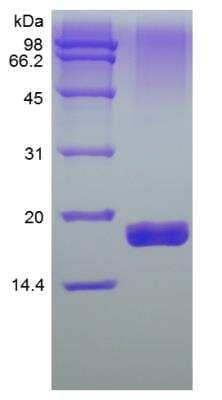 SDS-PAGE: Recombinant Human TRAILR2/TNFRSF10B Protein [NBP2-35030]