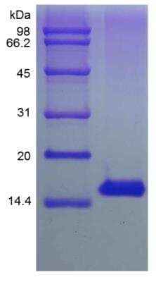 SDS-PAGE: Recombinant Human TSLP Protein [NBP2-35083]