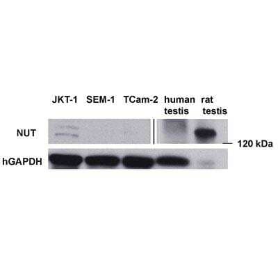 Western Blot: Human Testis Whole Tissue Lysate (Adult Whole Normal) [NB820-59266]