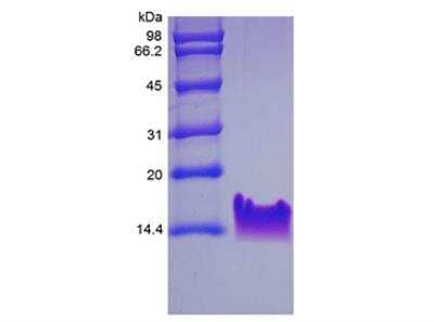 SDS-PAGE: Recombinant Human Thymosin beta 4 Protein [NBP2-35087]