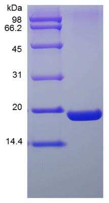 SDS-PAGE: Recombinant Human UBE2I/Ubc9 His (N-Term) Protein [NBP2-35094]