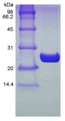 SDS-PAGE: Recombinant Human UBE2K/E2-25K His (N-Term) Protein [NBP2-35096]