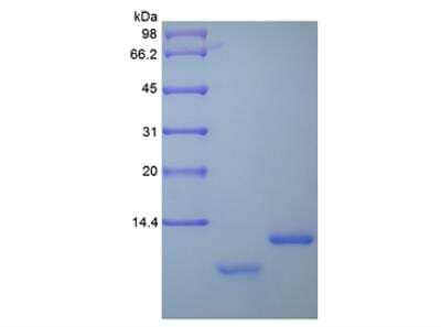 SDS-PAGE: Recombinant Human Uteroglobin/SCGB1A1 Protein [NBP2-35126]