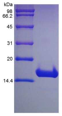 SDS-PAGE: Recombinant Human p16INK4a/CDKN2A Protein [NBP2-35199]