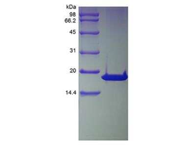 SDS-PAGE: Recombinant Human p16INK4a/CDKN2A TAT Protein [NBP2-35200]