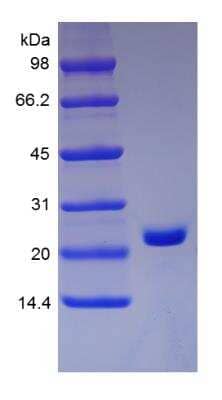 SDS-PAGE: Recombinant Human sRank Receptor/TNFRSF11A Protein [NBP2-35272]