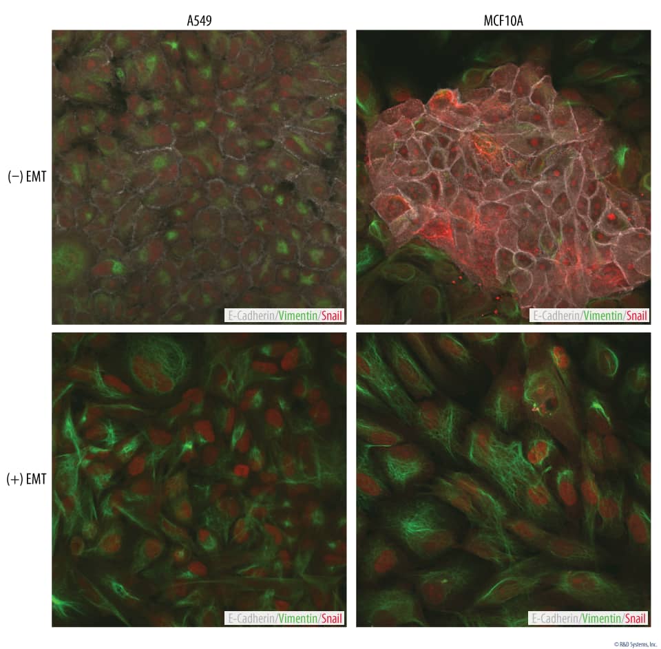 Upregulation of the Mesenchymal Markers, Snail and Vimentin, in EMT-induced Cells