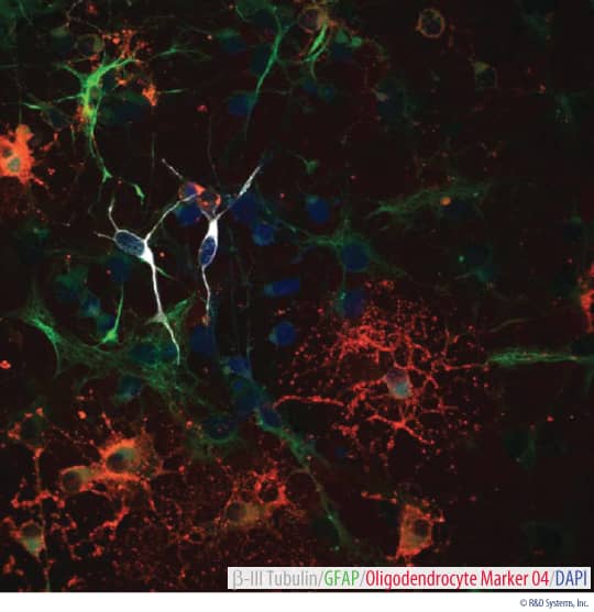 Beta-III Tubulin, GFAP, and Oligodendrocyte Marker O4 in Differentiated Rat Cortical Stem Cells.