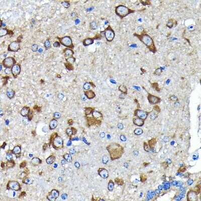 Immunohistochemistry-Paraffin: Huntingtin Antibody (7B9C8) [NBP3-15642]