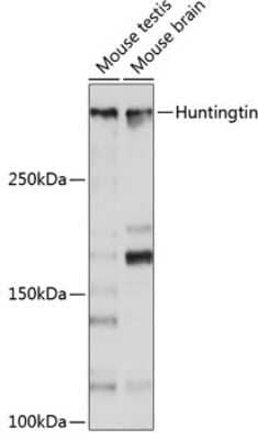 Western Blot: Huntingtin Antibody (7B9C8) [NBP3-15642]