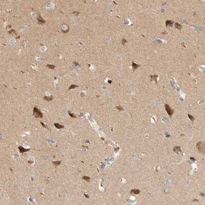 Immunohistochemistry-Paraffin: Huntingtin Antibody [NBP1-89710]